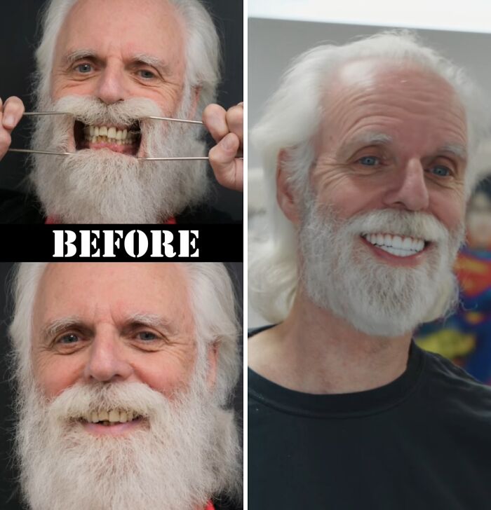 Elderly man smiling confidently after dental work transformation showing improved teeth and bright smile.