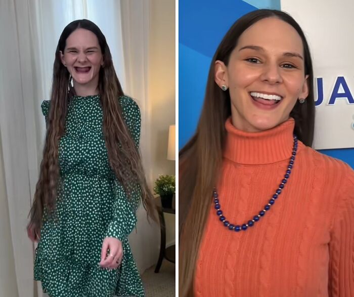 Side-by-side images of a woman before and after dental work smiling confidently, showcasing improved teeth and happiness.