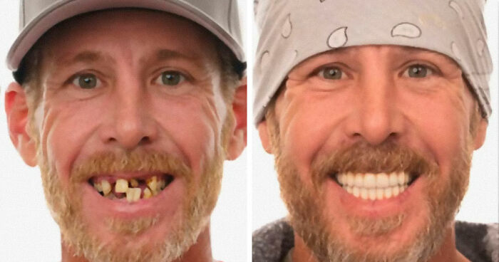 53 Dental Before-And-Afters That Prove Teeth Can Change Your Whole Appearance