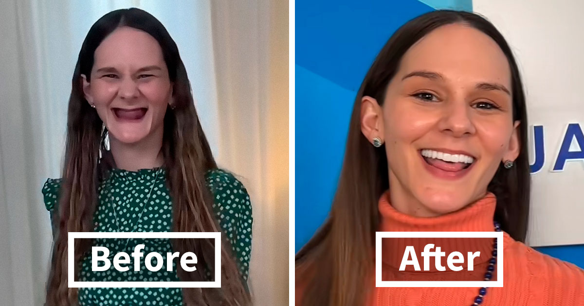 53 Dental Transformations That Led To Striking Glow-Ups