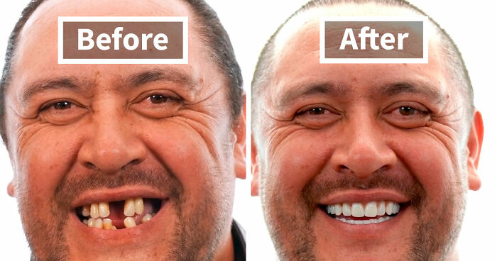 53 Striking Smile Transformations That Highlight The Power Of Dental Care