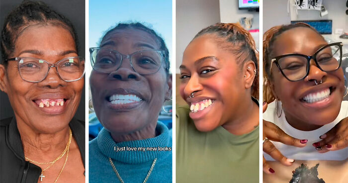 53 Dental Work That Made People Smile Without Hesitation And Shame