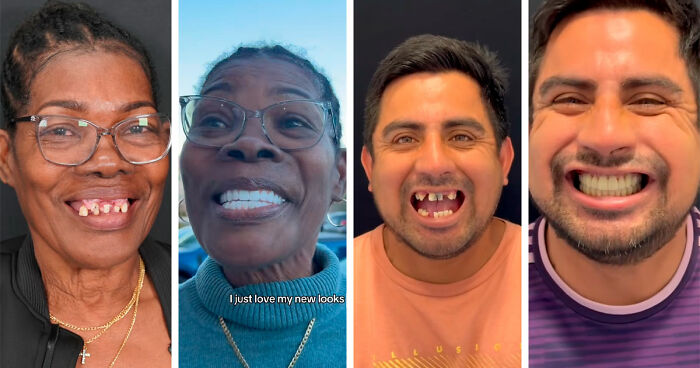 53 Striking Smile Transformations That Highlight The Power Of Dental Care