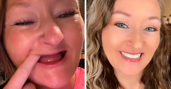 53 Dental Work That Made People Smile Without Hesitation And Shame