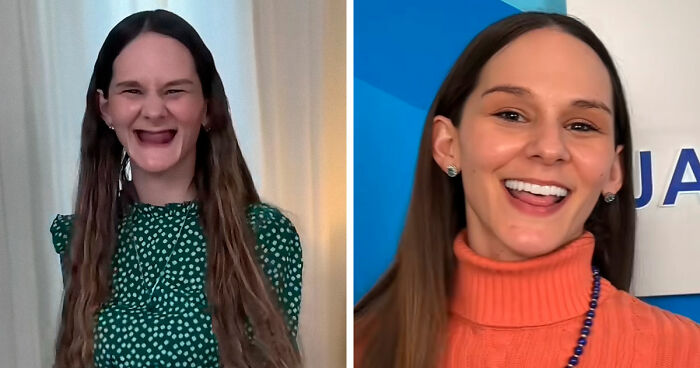 53 Dental Transformations That Led To Striking Glow-Ups