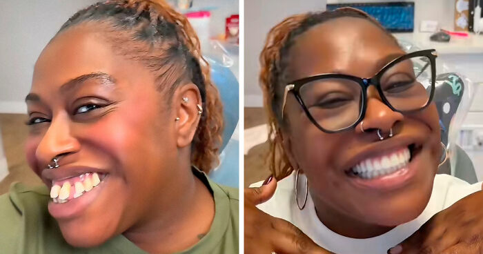 53 Dental Before-And-Afters That Prove Teeth Can Change Your Whole Appearance