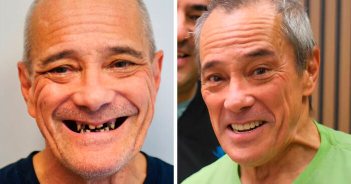 53 Dental Before-And-Afters That Prove Teeth Can Change Your Whole Appearance