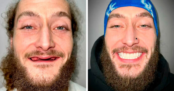 53 Dental Transformations That Led To Striking Glow-Ups