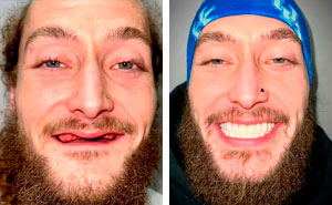 53 Dental Transformations That Led To Striking Glow-Ups