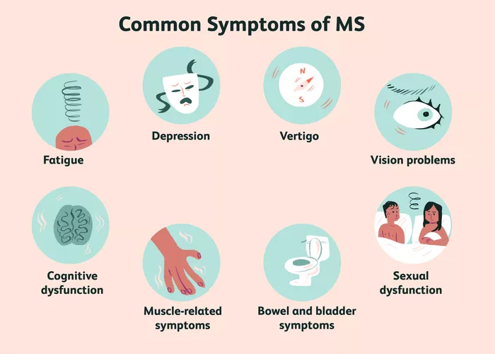 Illustration showing common symptoms of MS including fatigue, depression, vertigo, vision problems, cognitive dysfunction, muscle and bowel symptoms.