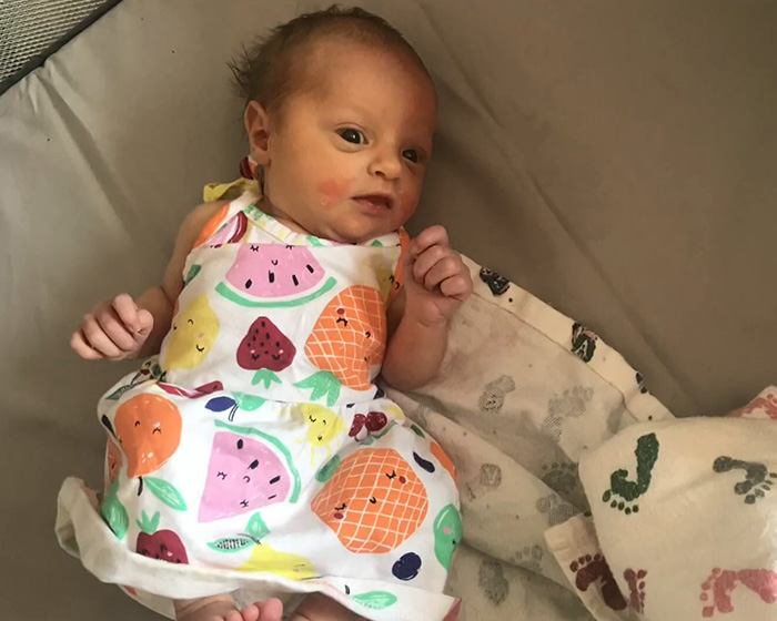 Baby girl lying on a bed wearing a colorful fruit-patterned dress, related to horrifying exchange between young parents.