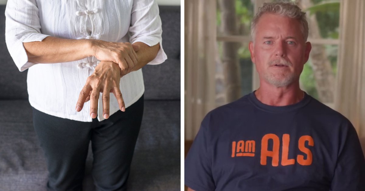 Doctors Break Down Commonly Ignored ALS Symptoms After Eric Dane Hand Claim