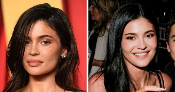 “She Dissolved That Lip?”: Fans Spot Major Detail In Kylie Jenner’s Appearance At The 2026 BAFTAs