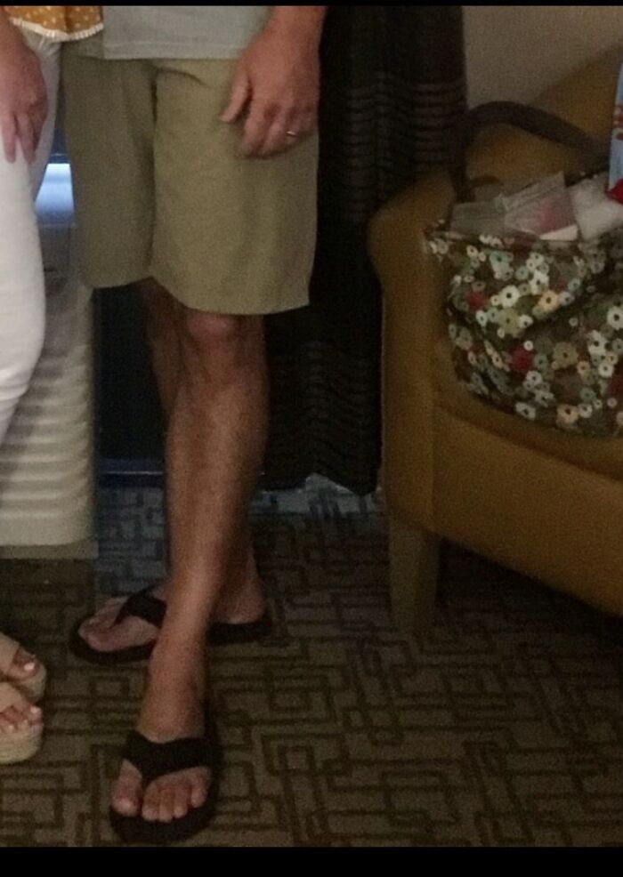 Man wearing sandals and shorts standing with awkward body language near a chair indoors, highlighting men’s awkward body language.