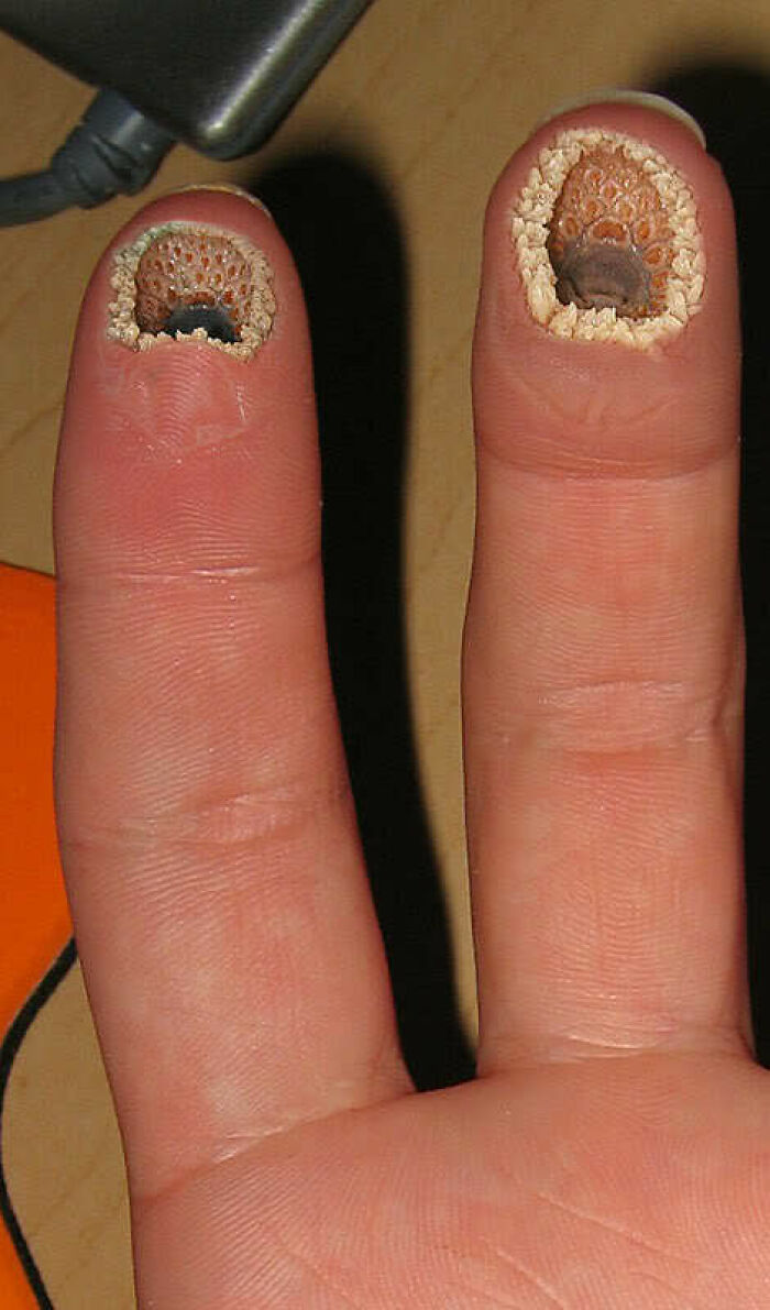 Close-up of two fingers with nails transformed into unhinged and wild pics resembling coral or barnacles, no Photoshop.