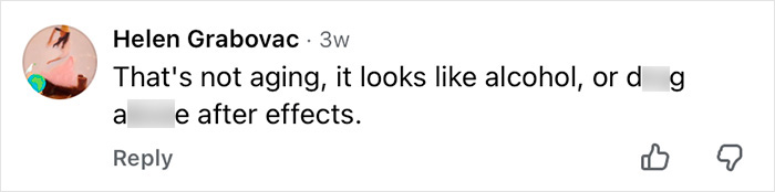 Comment on social media discussing aging effects compared to cosmetic procedure results related to Mickey Rourke appearance.