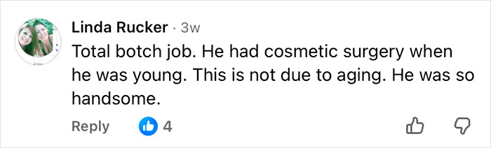 Comment discussing Mickey Rourke&rsquo;s appearance without dramatic cosmetic procedures, highlighting his youthful handsomeness.