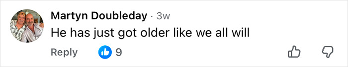 Comment by Martyn Doubleday stating he has just gotten older like everyone else, related to Mickey Rourke cosmetic procedures.