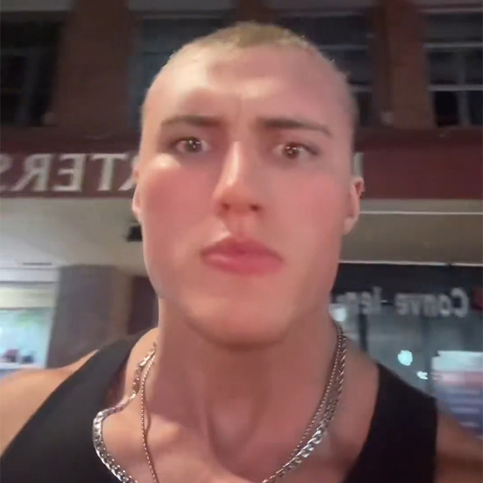 Close-up of an influencer looking distressed outdoors after his wig was snatched by a stranger, breaking his silence.