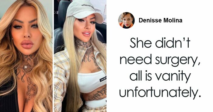 Influencer Bianca Dias Passes Away Days After A Major Cosmetic Procedure