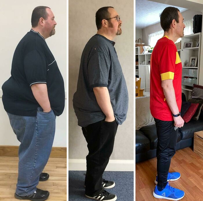 Three-panel side view of a man showing dramatic before and after weight loss transformation over time.