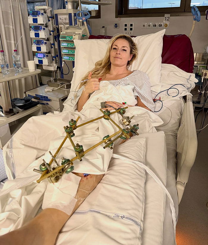 Lindsey Vonn lying in hospital bed with leg brace and medical equipment after Olympics accident recovery update.
