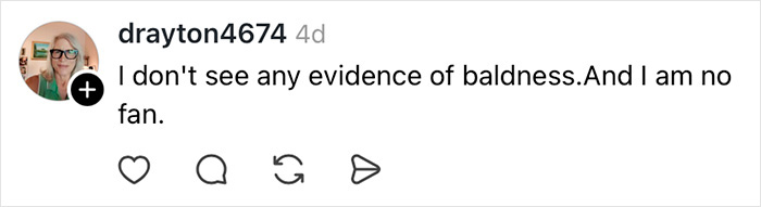 User comment on social media questioning baldness, discussing Melania Trump’s perfectly polished appearance slipping as the wind uncovers a hidden secret.