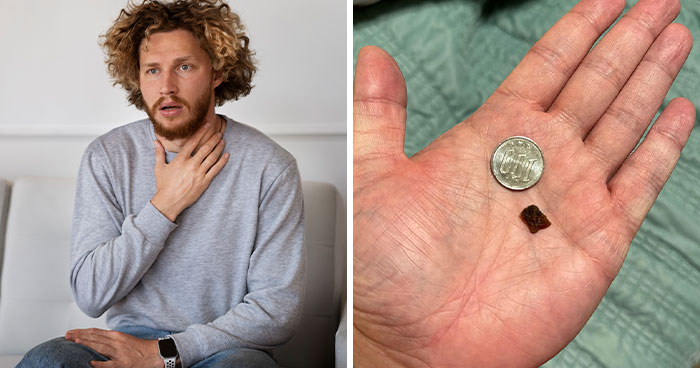 “I Could Barely Eat”: Man Spends 35 Years With Throat Pain, Finally Solves His Own Medical Mystery