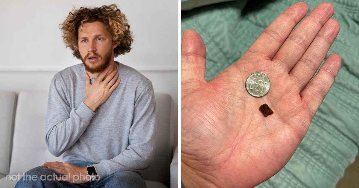 “I Could Barely Eat”: Man Spends 35 Years With Throat Pain, Finally Solves His Own Medical Mystery