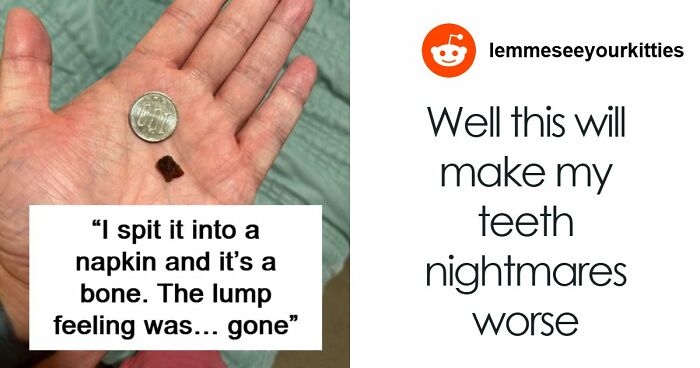 “Chasing Diagnoses For 35 Years—And The Answer Was In My Dinner”