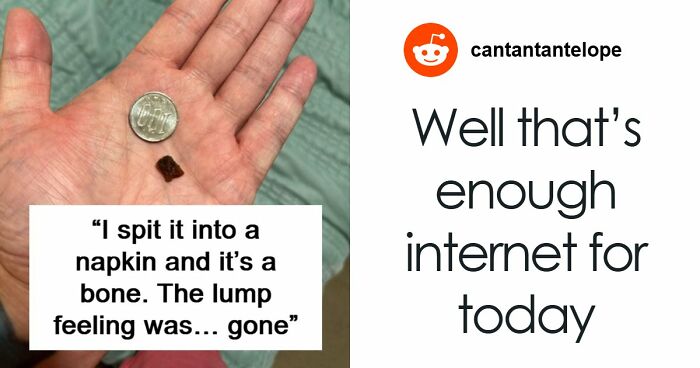 “Chasing Diagnoses For 35 Years—And The Answer Was In My Dinner”