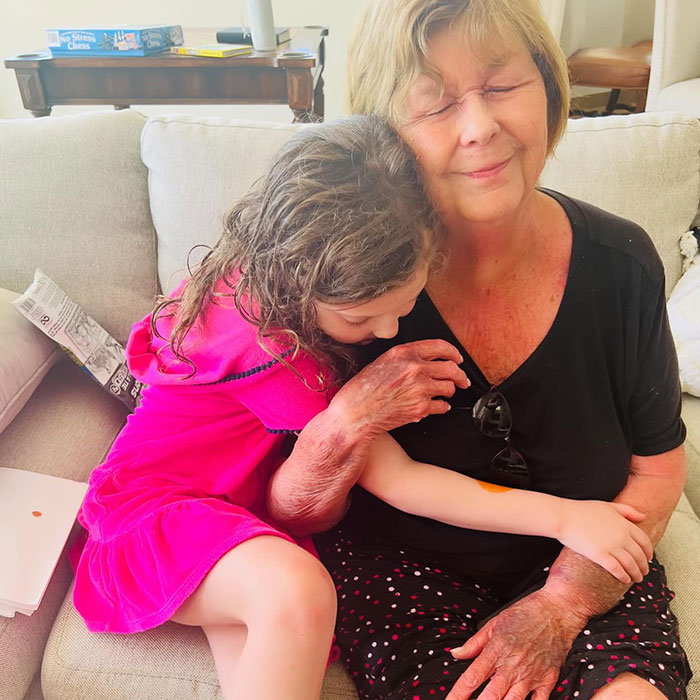 Young girl hugging elderly woman showing skin injuries, symbolizing Nancy Guthrie kidnapping video decoded by experts breakthrough.