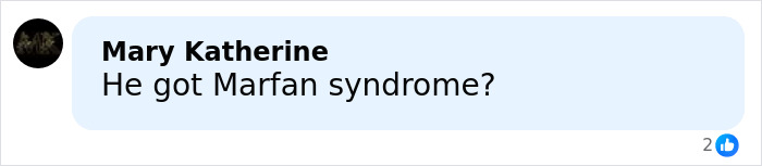 Facebook comment saying He got Marfan syndrome with two likes in a discussion about Barron's height and Trump's explanation.