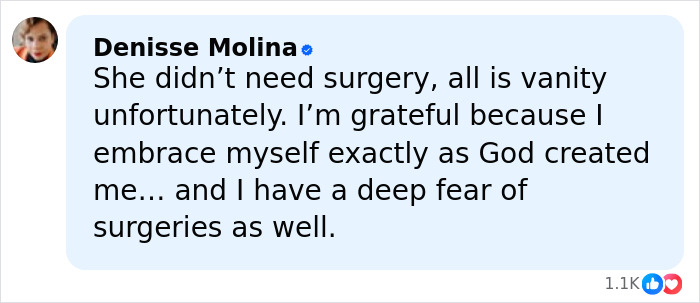 Comment from verified user Denisse Molina expressing fear of surgeries and valuing natural beauty over plastic surgery risks.