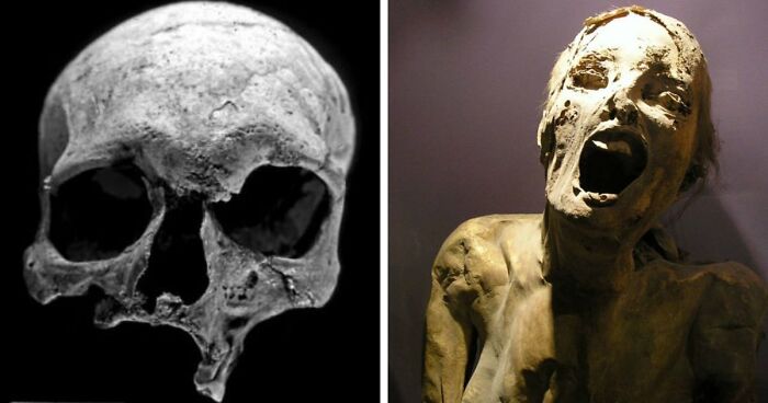 “The First Leper”: 38Times Archaeologists Dug Up Something Straight Out Of A Nightmare