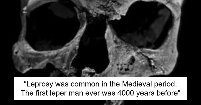 “The First Leper”: 38Times Archaeologists Dug Up Something Straight Out Of A Nightmare