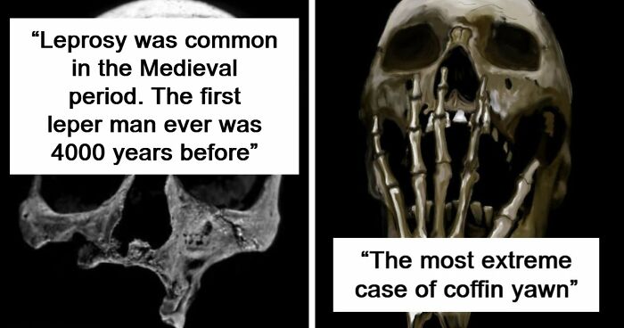 “The First Leper”: 38Times Archaeologists Dug Up Something Straight Out Of A Nightmare