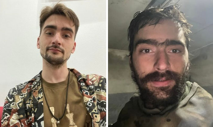 Before-and-after photos of a Ukrainian soldier showing the impact of war on his appearance and condition.