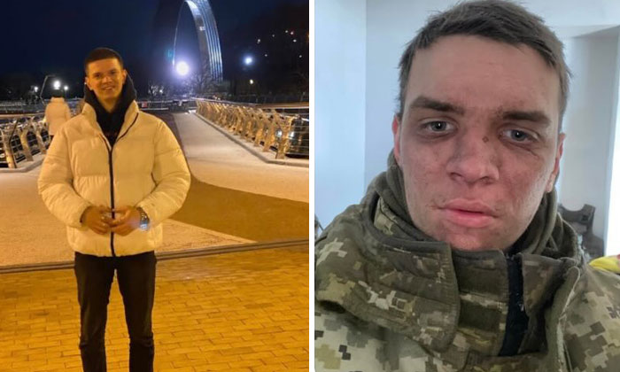 Before-and-after photos of a Ukrainian soldier showing the powerful impact of war on his appearance and life.