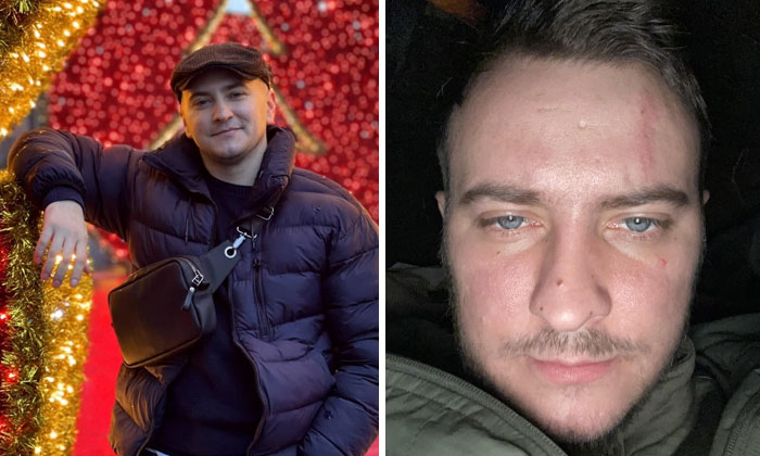 Before-and-after photos of a Ukrainian soldier showing the powerful impact of the war on his appearance and expression.