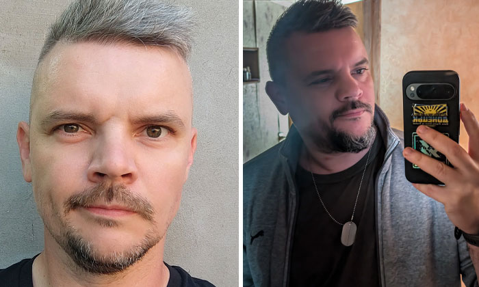 Before and after photos of a Ukrainian soldier showing changes in appearance since the start of the war.