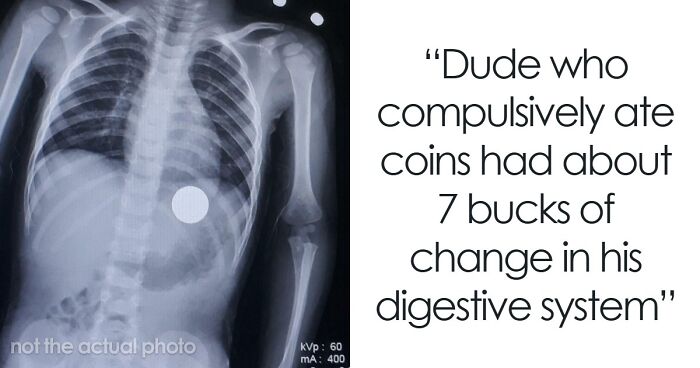 44 Autopsy Doctors Share The Most Bizarre Cases They’ve Ever Seen