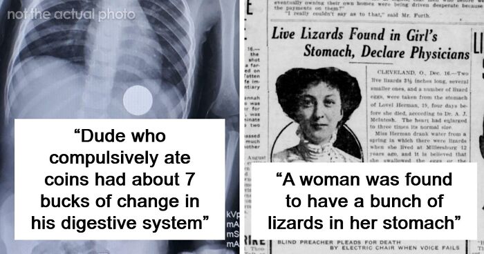 44 Shocking Things Doctors Never Expected To Find During Autopsies