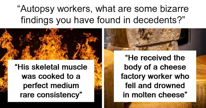 44 Autopsy Doctors Share The Most Bizarre Cases They’ve Ever Seen
