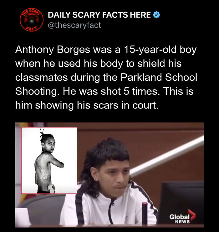 Anthony Borges showing scars in court after shielding classmates during Parkland School Shooting, a true scary fact.