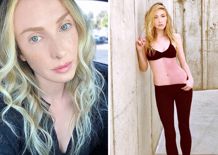 Young woman with blonde hair showing signs of a bizarre medical problem featured in medical mysteries that made headlines.