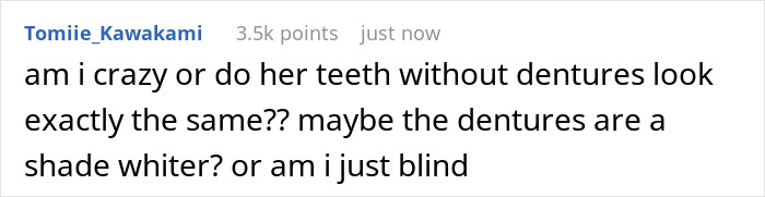 "Como você faz um retorno": Acompanhamento brilhante da rainha da beleza após perder os dentes durante o concurso "Como você faz um retorno": Acompanhamento brilhante da rainha da beleza após perder os dentes durante o concurso