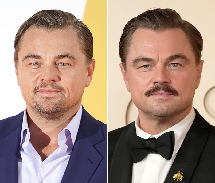 Actor on Oscars red carpet showing effects of plastic surgery and weight loss side effects in close-up portraits.