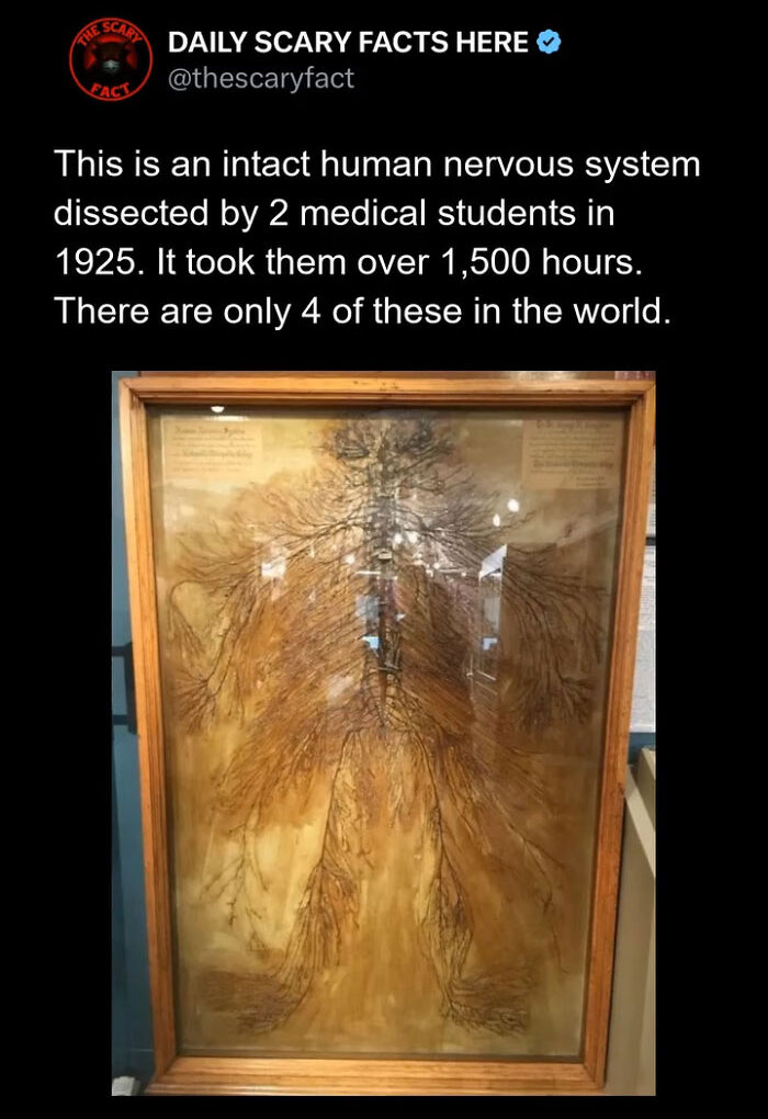 Intact human nervous system dissection displayed in a wooden frame, highlighting a rare and detailed anatomical specimen.