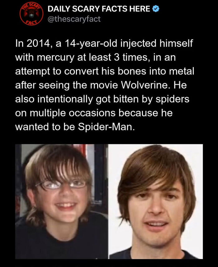 Text post from Daily Scary Facts about a teen injecting mercury and getting spider bites, with before and after photos.